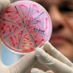 Менингококковая инфекция – одна из самых опасных бактериальных инфекций