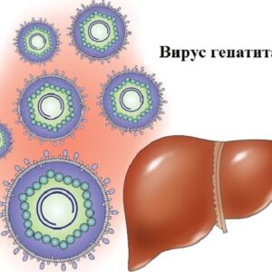 В Сморгони зарегистрирован еще один случай вирусного гепатита «А»