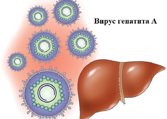 В Сморгони зарегистрирован еще один случай вирусного гепатита «А»