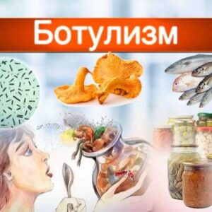 Профилактика  ботулизма