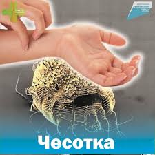 ЧЕСОТКА! ОСНОВНЫЕ МЕРЫ ПРОФИЛАКТИКИ! ЧЕСОТКА! ОСНОВНЫЕ МЕРЫ ПРОФИЛАКТИКИ!