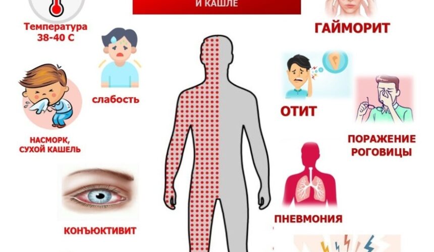 Корь. Как защититься от вируса?