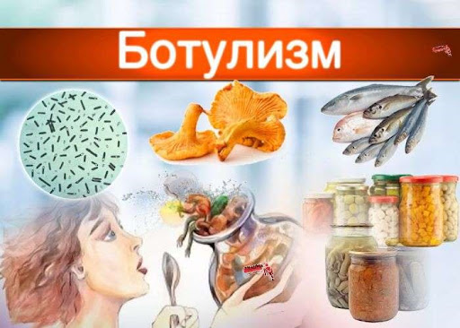 Профилактика ботулизма.